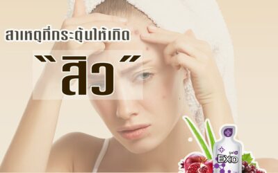 สิ่งกระตุ้นให้เกิดสิว