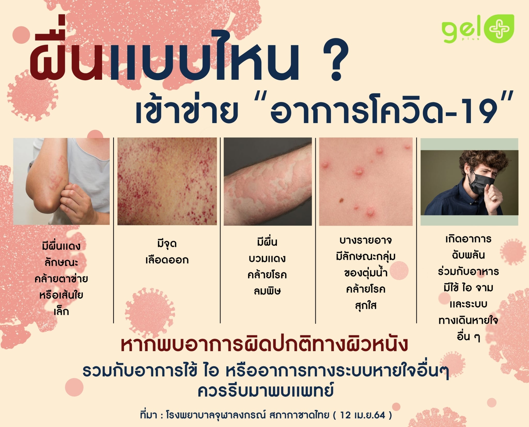 GELPLUS-ผื่นแบบไหนใช่โควิด