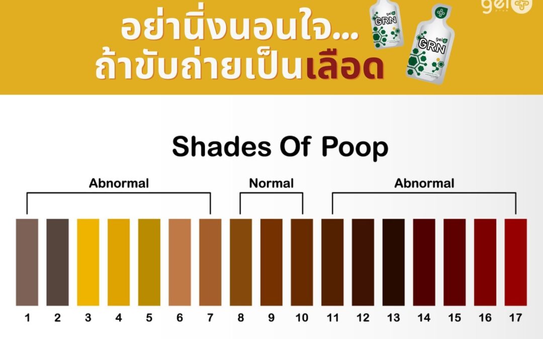 ถ่ายเป็นเลือด