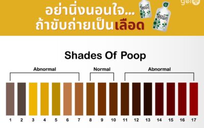 ถ่ายเป็นเลือด