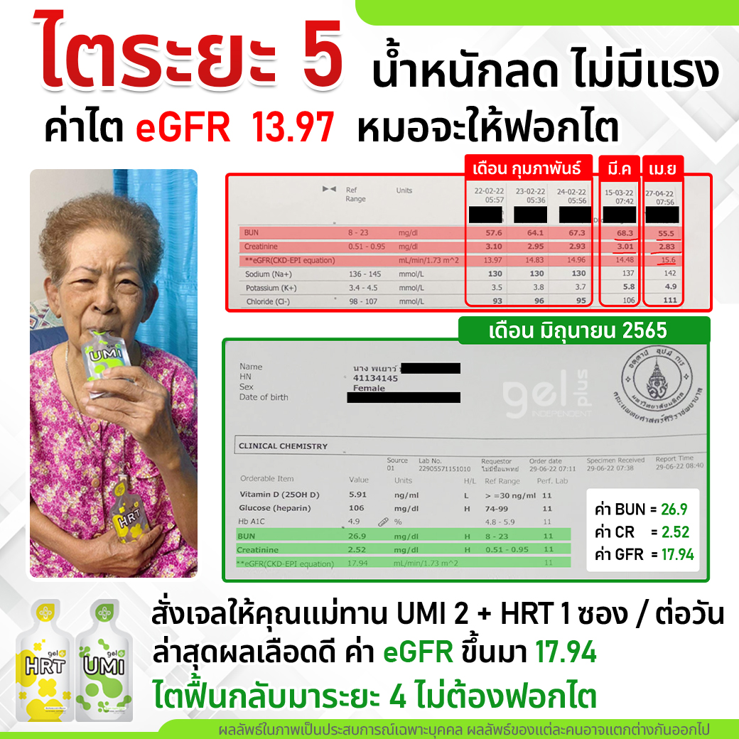 รีวิว ไตระยะ 5 น้ำหนักลด ไม่มีแรง